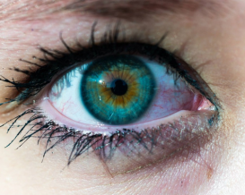 Dry eye syndrome - 21st century plague1