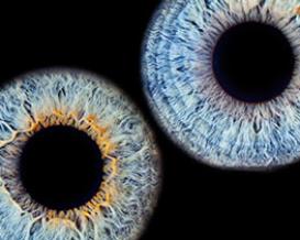 Die Iris - natürlicher Blendschutz für das Auge1
